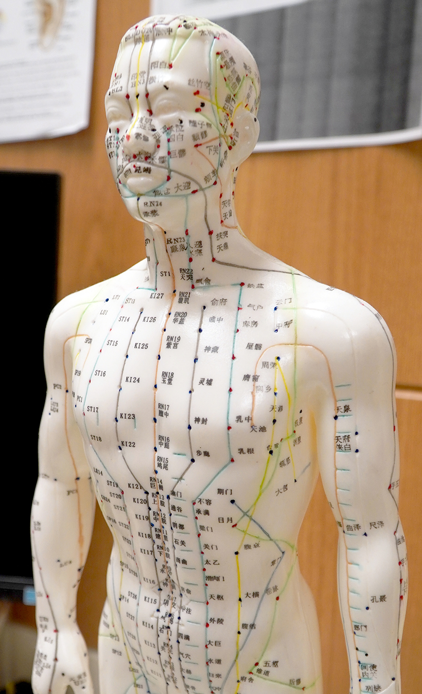 Cheltenham Affordable Acupuncture